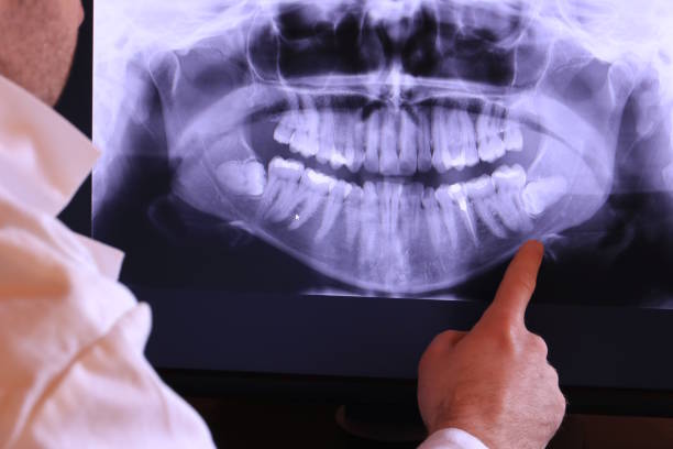 Best Dental Abscess Treatment in Oakdale, LA
