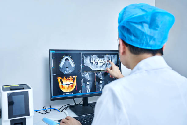 Best Emergency Wisdom Tooth Extraction in Oakdale, LA