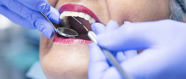Best Weekend Emergency Dental Services in Oakdale, LA